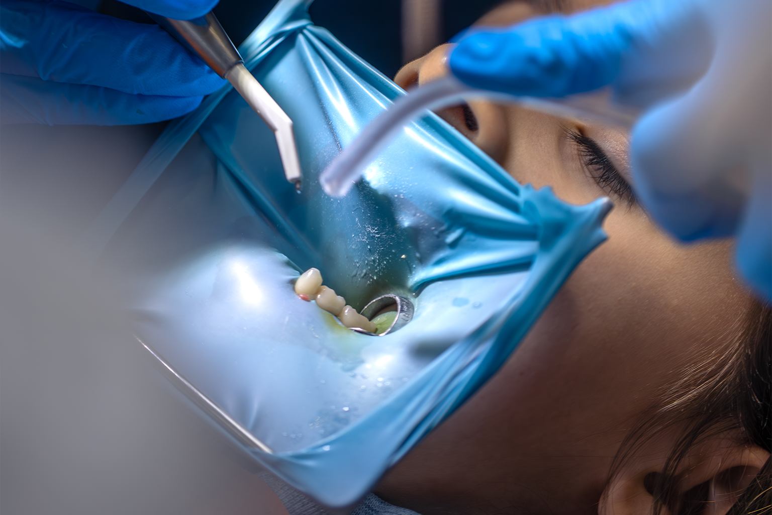 Preventive Dentistry
